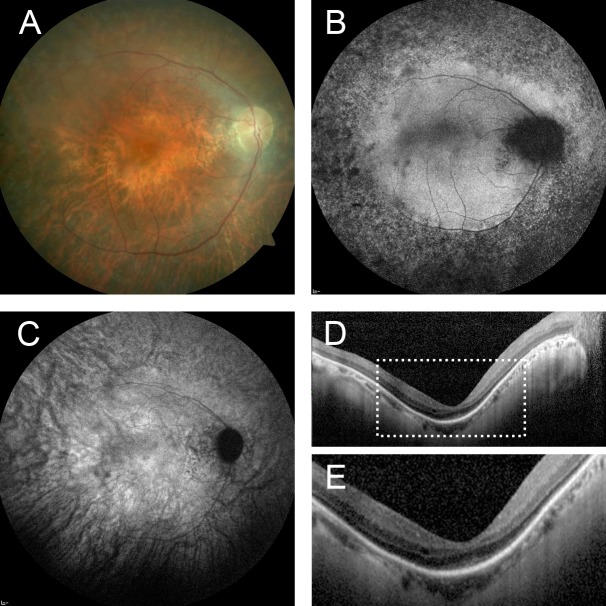 Fig 4