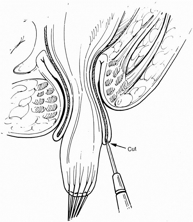 graphic file with name 10FF4.jpg