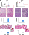 Figure 1. The human anti-CD99 dAbd C7 inhibits tumor growth and increases macrophages infiltration. A, Tumor volume after treatment with the anti-CD99 dAbd C7 in xenografts derived from injection of 6647 cells in nude mice. Control, n = 10; dAbd C7, n = 6 (left) or PDX-EW#2 tumors developed in NSG mice; control, n = 4; dAbd C7, n = 5 (right). Dots represent single tumor volumes, mean ± SD are displayed. Mann–Whitney U test, *, P < 0.05. B, Representative H&E images of 6647 (left) or PDX-EW#2 (right) xenografts treated or not with dAbd C7 (scale bar, 50 μm). The tumor regions with nuclear condensation and the total area of the samples were identified by manually marking with Image J software. Histogram represents the percentage of tumor area with nuclear condensation (vs. total tumor area). Data are expressed as the median and range (minimum–maximum). Mann–Whitney U test, *, P < 0.05. C, Representative images of double staining IHC for F4/80 murine macrophages (brown) and CD99 EWS cells (red) in 6647 (left) or PDX-EW#2 (right) xenografts after treatment with dAbd C7 (scale bar, 50 μm). The enlarged box shows a mouse macrophage with engulfed EWS cells; the histograms represent the percentage of F4/80-positive cells calculated after evaluation of at least ten fields. Data are expressed as the median and range (minimum–maximum. Mann–Whitney U test; ***, P < 0.001.