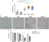 Figure 2. Macrophage-mediated phagocytosis and cytotoxicity of EWS cells after anti-CD99 antibodies treatment. A, Phagocytic index of M0-like macrophages cocultured for 6 hours with TC-EGFP cells being exposed to anti-CD99 antibodies (12E7 mAb; 0662 mAb; dAbd C7 or to irrelevant MOPC21 antibody used as isotype control) for 30 minutes. Phagocytic index indicated the number of EWS cells phagocytosed per 100 macrophages. Dots represent single fields and data are expressed as the median and range (minimum–maximum) of at least three independent experiments. One-way ANOVA: *, P < 0.05; **, P < 0.01; ***, P < 0.001. B, Representative images of M0-like macrophages phagocytosing EWS cells after treatment with anti-CD99 antibodies. Arrows point to phagocytosed tumor cells (scale bar, 50 μm). C, EWS cell survival in the presence or not of M0-like macrophages (Mφ) detected by Trypan blue vital counting. Data are expressed as percentage compared with untreated TC-71 cells. Bars represent the mean ± SD of at least three independent experiments. Mann–Whitney U test: *, P < 0.05; **, P < 0.01.