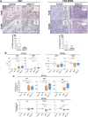 Figure 5. Ex vivo undifferentiated M0-like macrophages switch to M1-like phenotype when cocultured with EWS cells treated with agonistic anti-CD99 antibodies. A, Representative IHC images of murine F4/80+ and CD206+ macrophages in 6647 (left) and PDX-EW#2 (right) xenografts after treatment with dAbd C7 (scale bar, 50 μm). Low magnifications are inserted to show tumor morphology, and the box represents the field of view of the 40× images displayed for each antigen. Quantification of IHC staining of tumor tissue samples in each group were quantified by ImageJ software. Data are expressed as median and range (minimum–maximum). Mann–Whitney U test: *, P < 0.05; ***, P < 0.001. B, The relative expression of CD80, CD86, CD163, CD206 was analyzed by qPCR in M0-like macrophages cocultured with TC-EGFP cells treated with 0662 mAb or dAbd C7 as indicated in material and methods. Data are expressed as the median and range (minimum–maximum). Kruskal–Wallis test: *, P < 0.05; **, P < 0.01; ***, P < 0.001. C, Multiplex cytokine assay analysis of IL1β, IL6, TNFα, CCL18, TGFβ1, and IL4 release in M0-like macrophages cocultured with TC-71 EGFP cells treated with 0662 mAb or dAbd C7 as indicated in material and methods. Data are expressed as the median and range (minimum–maximum) of the fold increase versus control = 1. Kruskal–Wallis test: *, P < 0.05; **, P < 0.01; ***, P < 0.001.