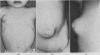 101