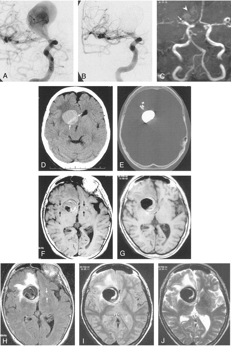 Fig 3.