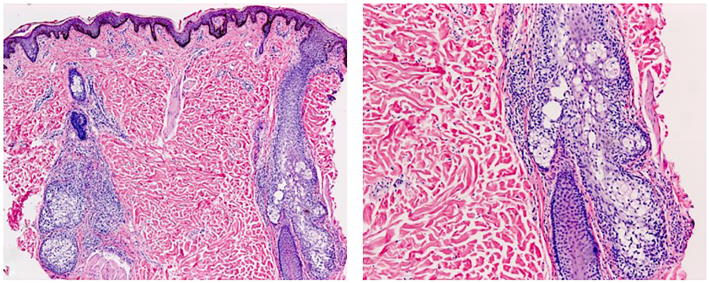 Fig 2