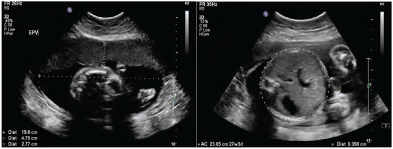 Figure 2: