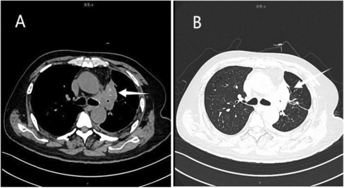 FIGURE 1