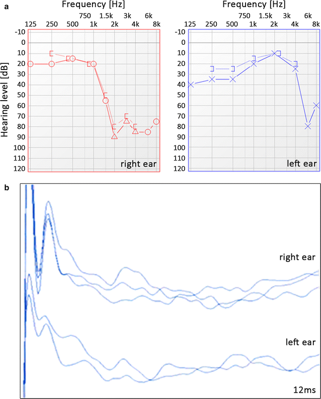 Fig. 2