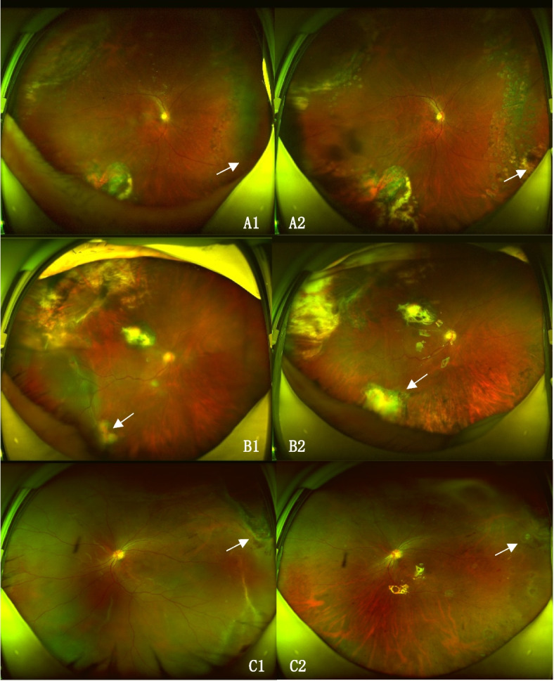 Fig. 1