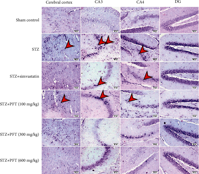 Figure 11