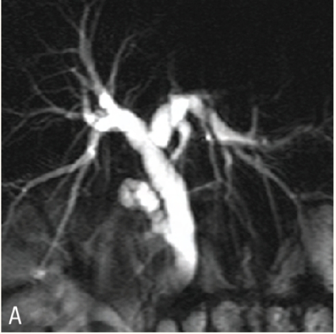 Figure 2a :