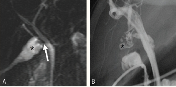 Figure 11 :