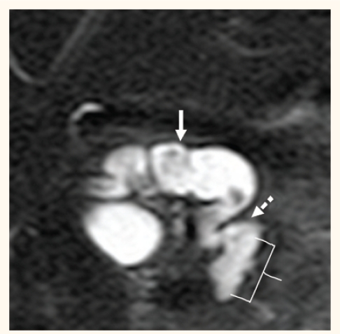 Figure 3: