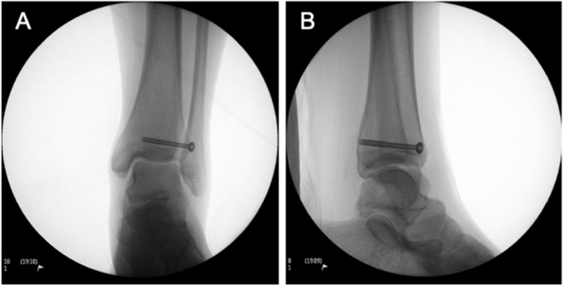 Fig. 4