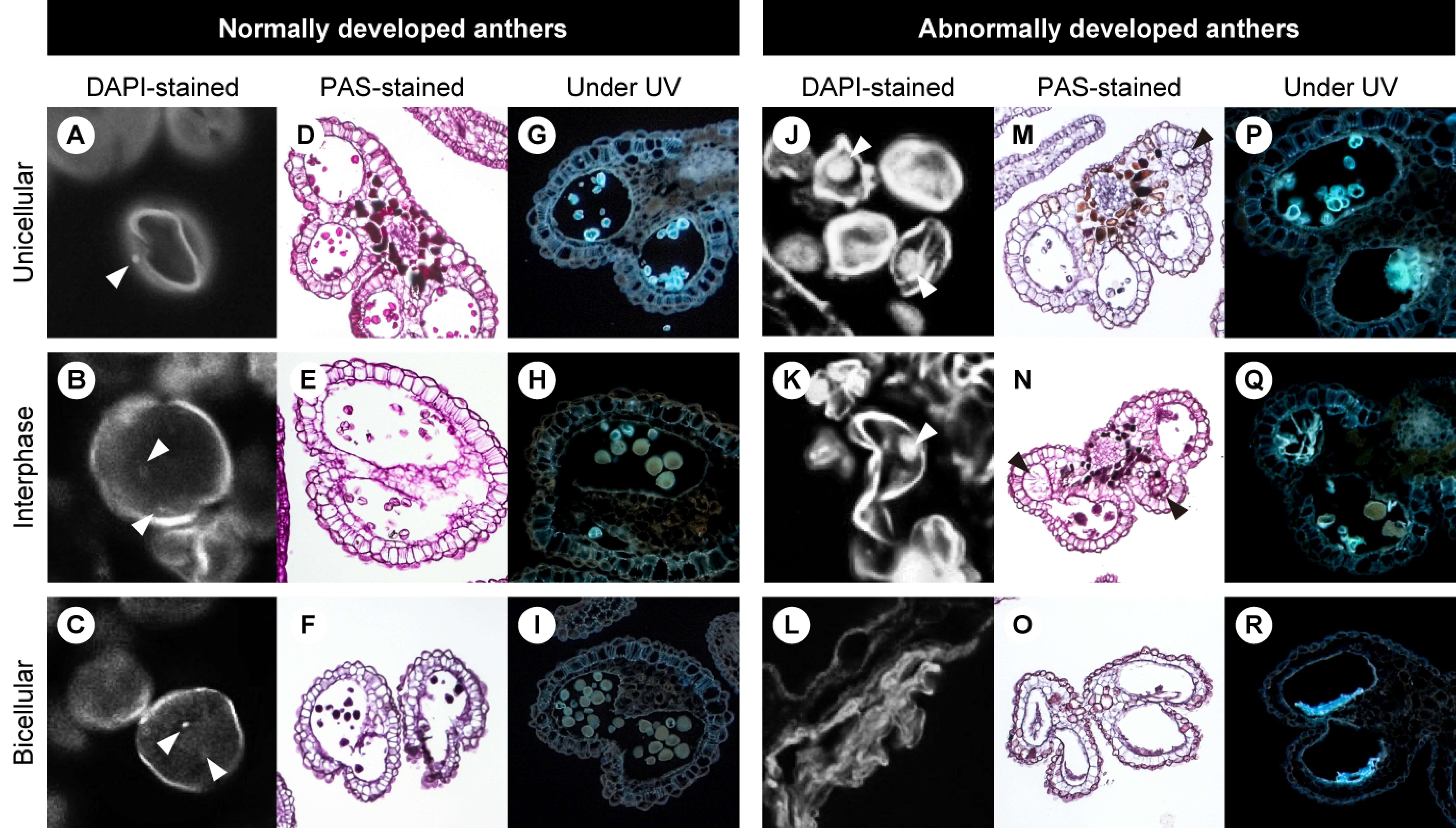 Figure 4. Sections of normally developed anthers with pollen (A–I) and abnormally developed anthers (J–R) at the unicellular microspore stage (A, D, G, J, M, P), interphase (B, E, H, K, N, Q), and bicellular pollen stage (C, F, I, L, O, R). Arrowheads indicate nuclei in (A–C, J, K) and vacuolated tapetum in (M, N).