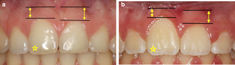 Fig. 6