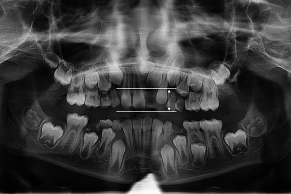 Fig. 4