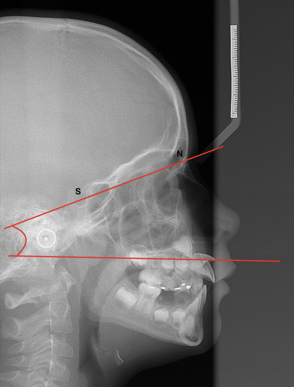 Fig. 5
