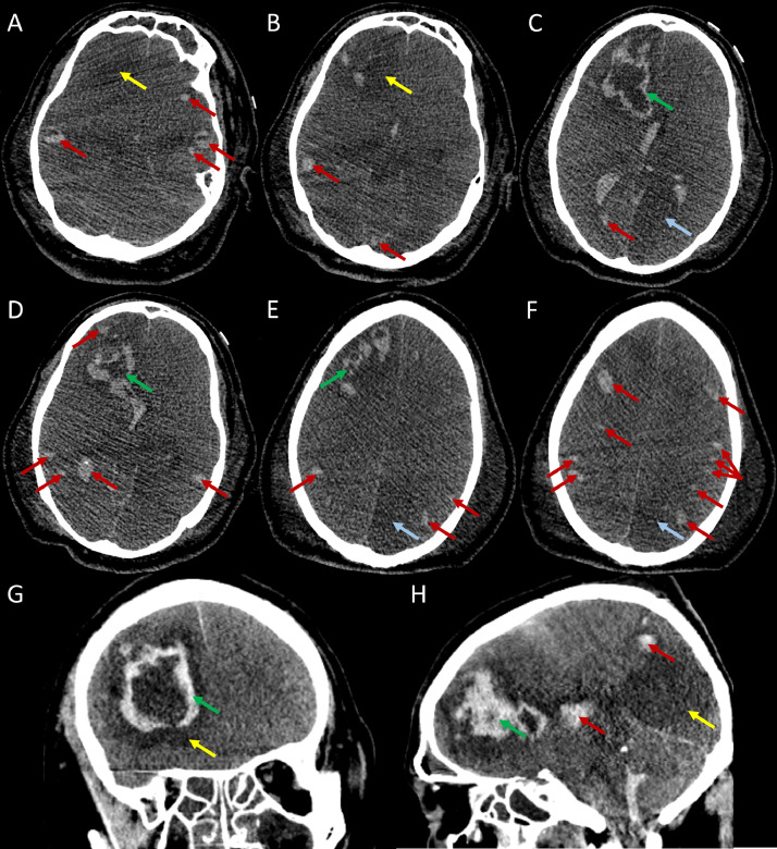 Fig 4