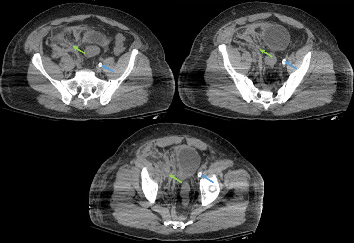 Fig 6