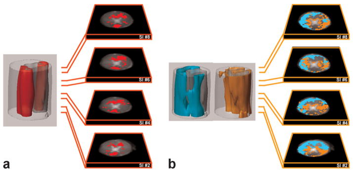 FIG. 3