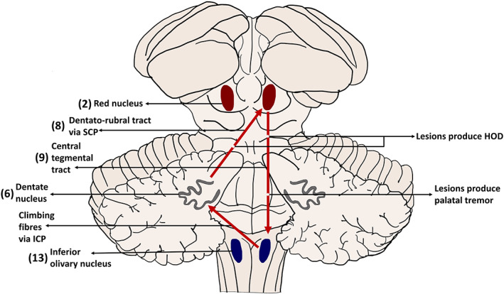 FIG. 4