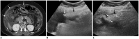 Fig. 12