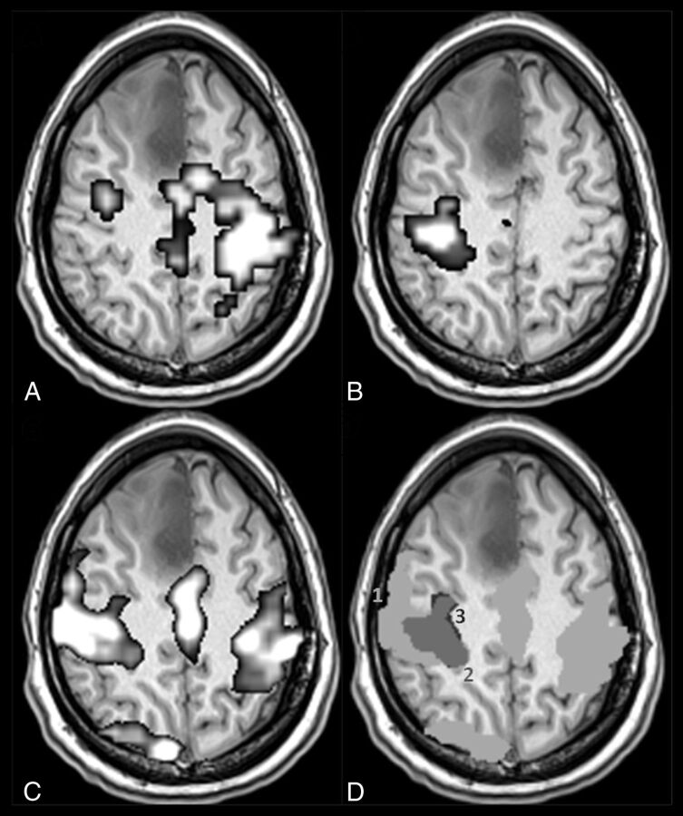 Fig 2.