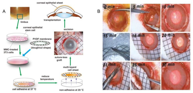 Figure 20