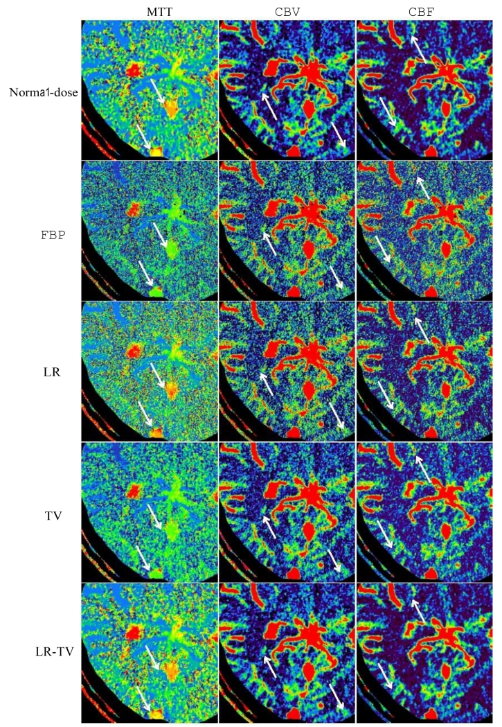 Figure 14