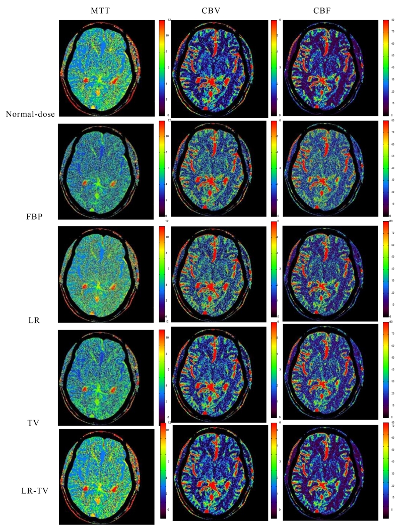 Figure 13