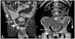 Figure 1 —