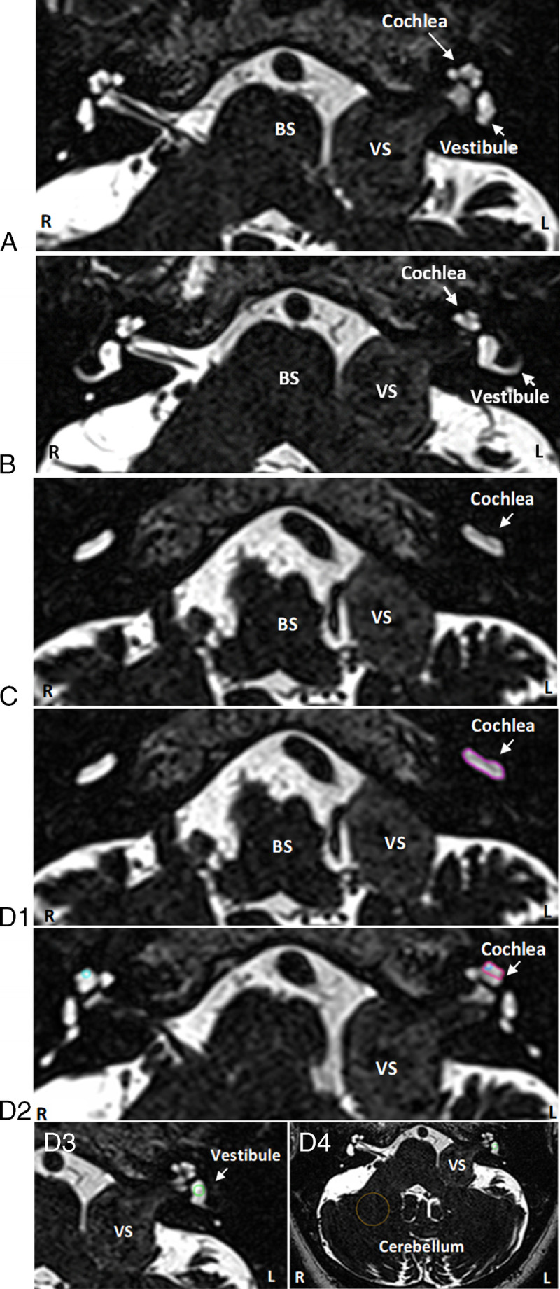 FIG. 1