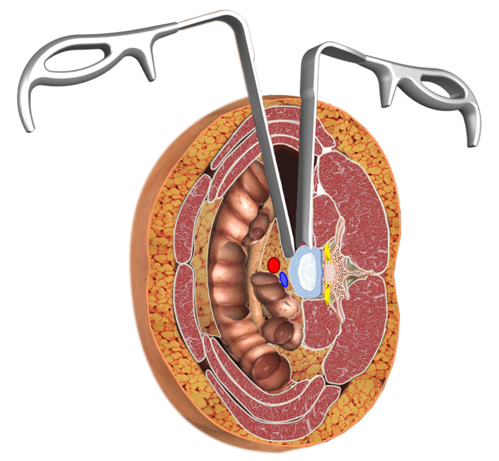 Fig. 1