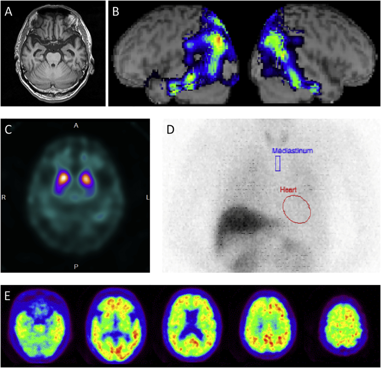 Fig. 1