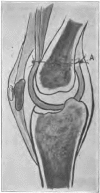 Fig. 37