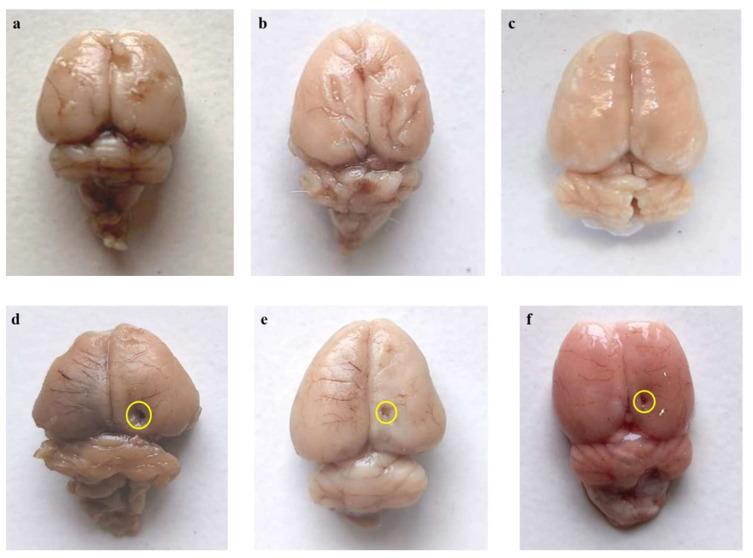 Figure 14