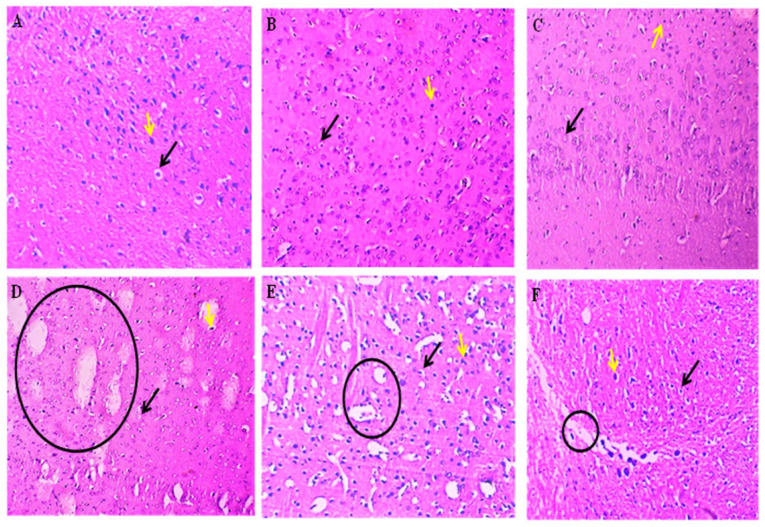 Figure 17