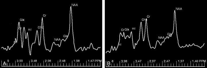 Fig 4.