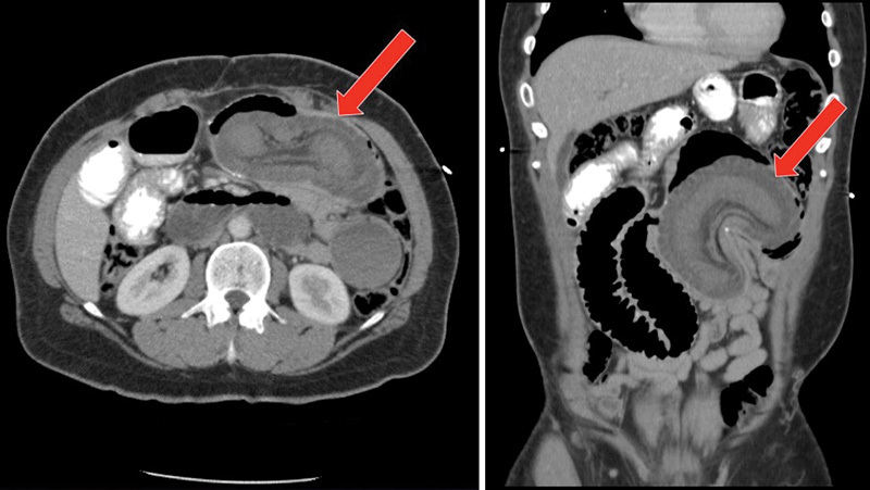 Fig. 4