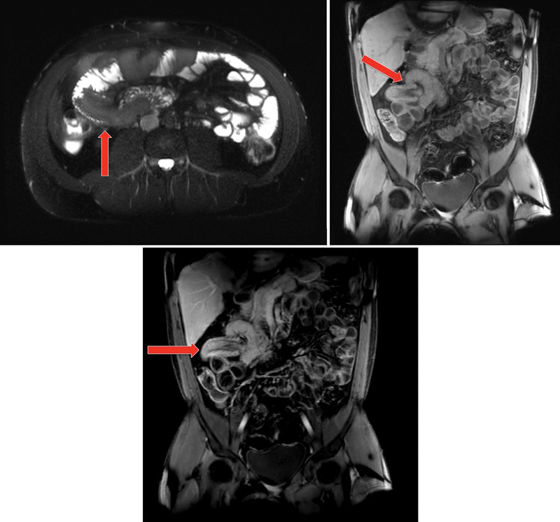 Fig. 5