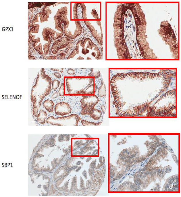 Fig.1