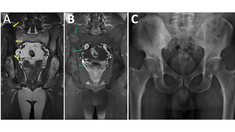 Figure 14