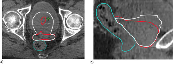 FIGURE 4