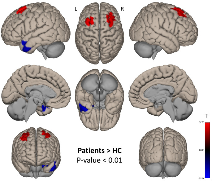 Fig. 2