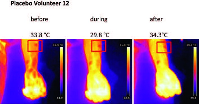 Fig. 11: