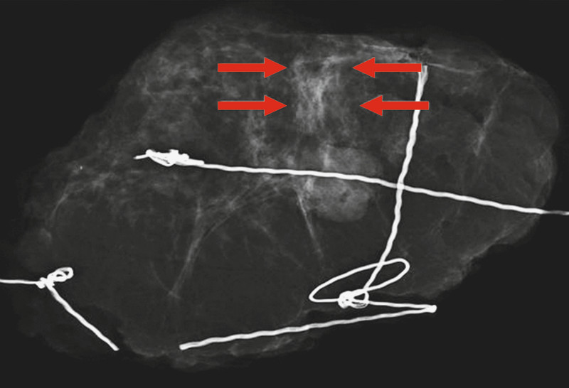 Fig. 2