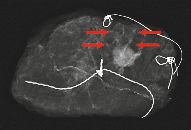 Fig. 1