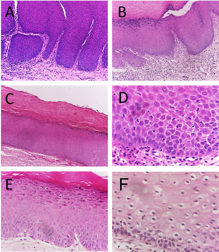 Fig 5