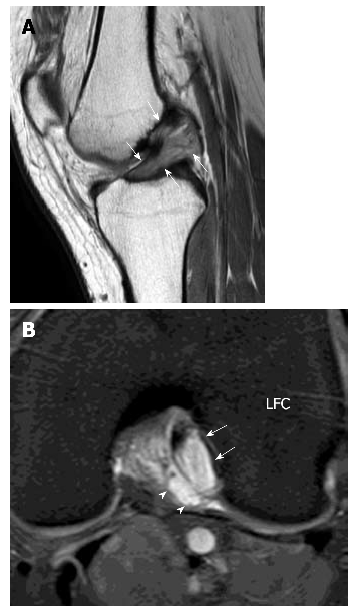 Figure 19