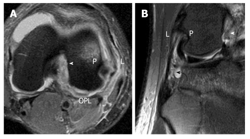 Figure 18